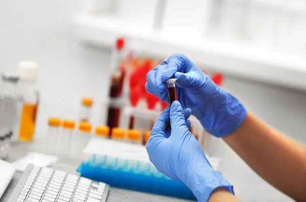 Scientist working with blood samples — Stock Photo, Image