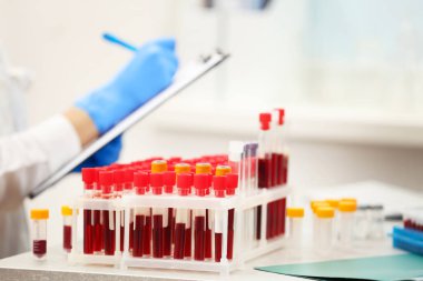 Test tüpleri kanla dolu