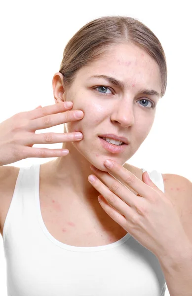 Beautiful Young Woman Popping Pimples White Background — Stock Photo, Image