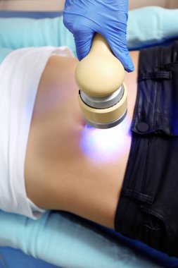 Modern kliniğinde, closeup lazer tedavisi gören genç kadın