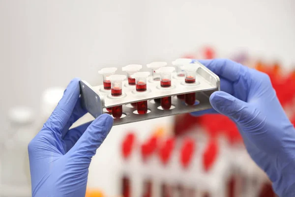 Científico trabajando con muestras de sangre — Foto de Stock