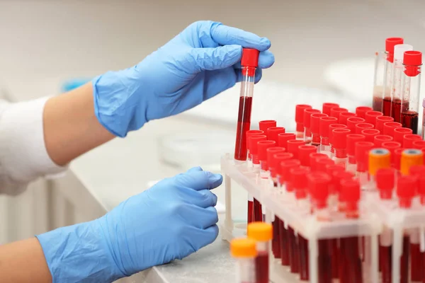 Forskare som arbetar med blodprov — Stockfoto
