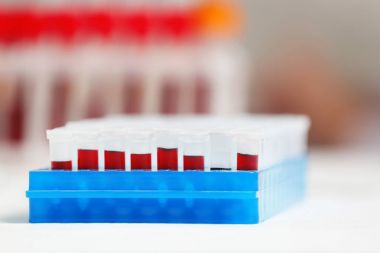 kan örnekleri ile test tüpleri