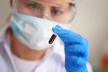 Cam tüp kan ile laboratuvar, closeup tutan kadın