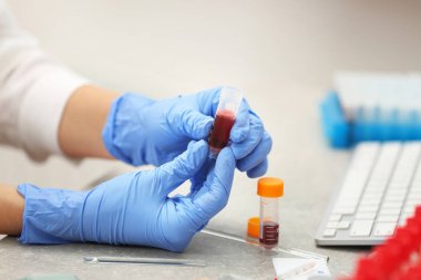 Bilim adamı kan örnekleri ile çalışma