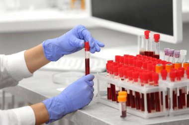 Bilim adamı kan örnekleri ile çalışma