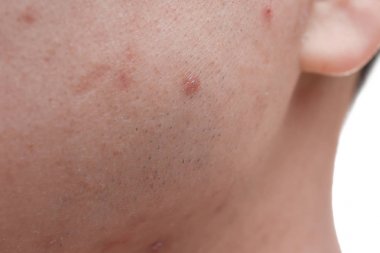 Sorun deri, closeup ile genç adam