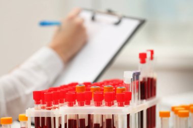 Test tüpleri kanla dolu