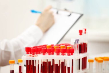 Test tüpleri kanla dolu