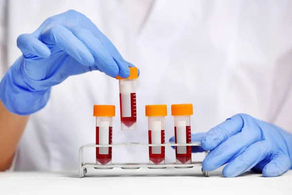 Woman working with blood samples — Stock Photo, Image