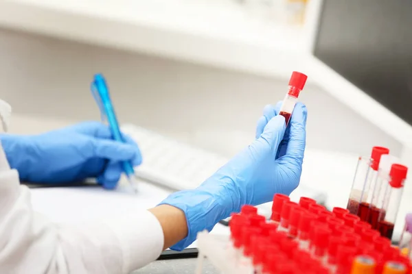 Científico trabajando con muestras de sangre — Foto de Stock