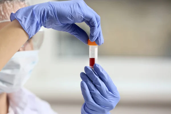 Mujer trabajando con muestra de sangre — Foto de Stock