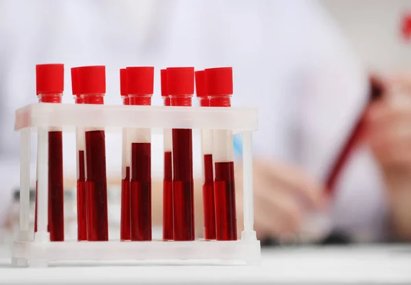 Тестовые трубки с образцами крови — стоковое фото