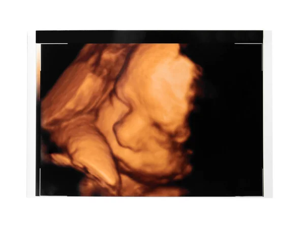 超声婴儿扫描 — 图库照片
