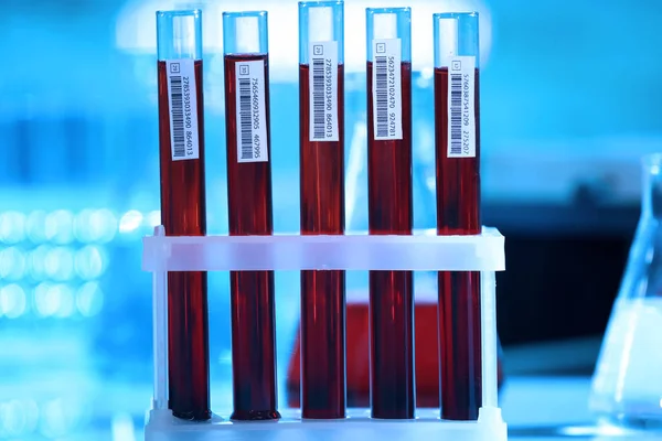 Test tüpleri ile kan — Stok fotoğraf