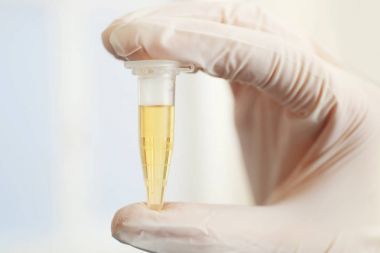 Doktor el ile test tüpü