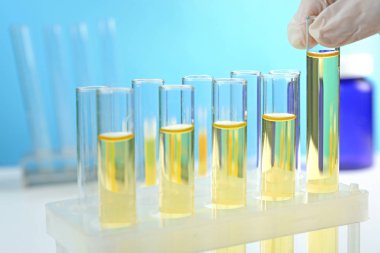 Doktor el ile test tüpleri