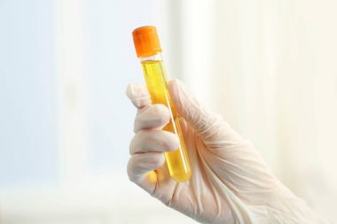 Doktor el ile test tüpü