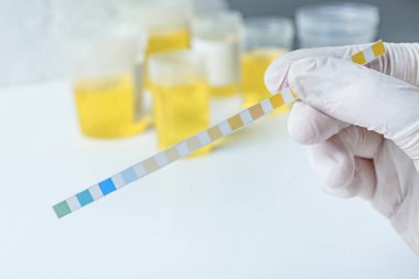 Doktor el ile test şeridi, portre