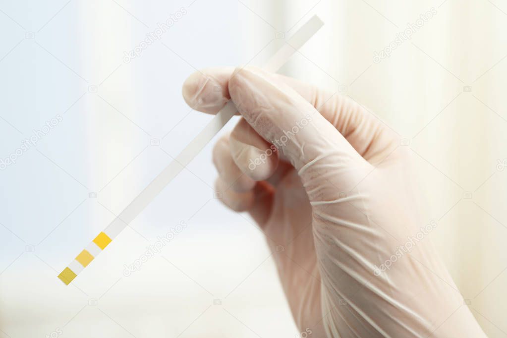 Doctor hand with test strip