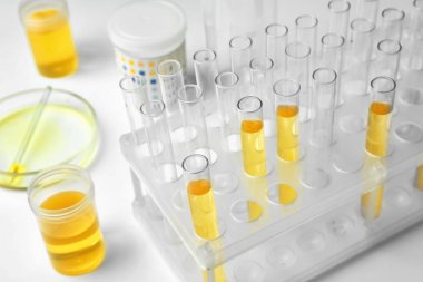 Laboratuvarda test tüpleri