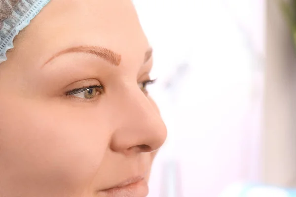 Mujer en proceso de eliminación de tatuajes de cejas —  Fotos de Stock