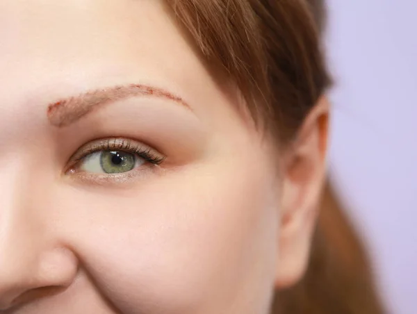 Frau im Prozess der Entfernung von Augenbrauen-Tattoos — Stockfoto