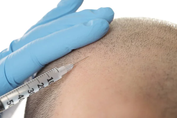Homem a receber injeção estimulante para o crescimento do cabelo, close-up — Fotografia de Stock