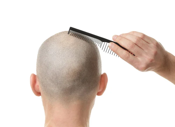 Conceito de perda de cabelo. Jovem com pente de cabelo no fundo branco — Fotografia de Stock