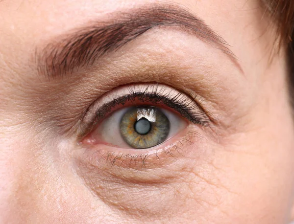 白内障のコンセプトです 年配の女性の目には クローズ アップ — ストック写真