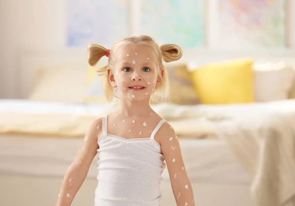 Little girl with chickenpox — Stock Photo, Image