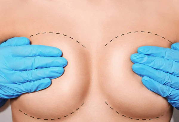 성형 수술 개념 — 스톡 사진