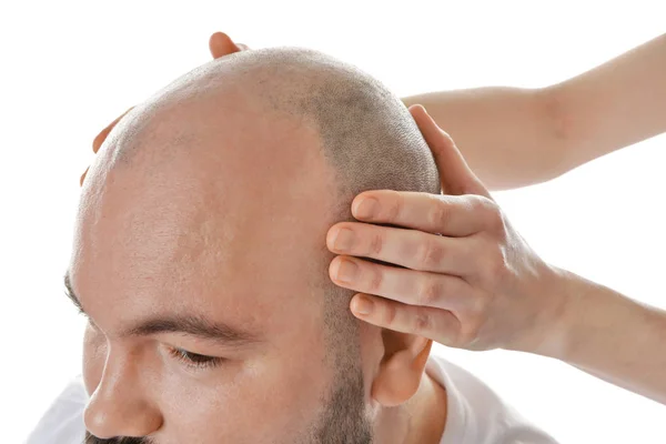 Bald adult man — Stock Photo, Image