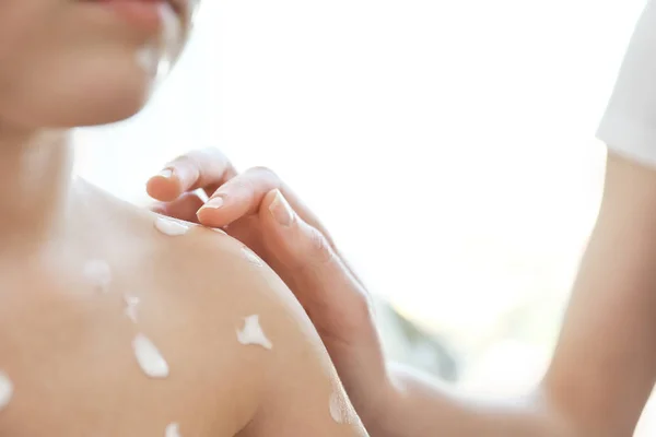 Child ill with chickenpox — Stock Photo, Image