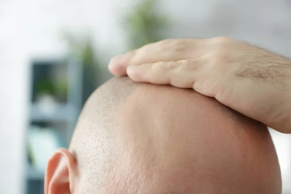 Hombre Adulto Calvo Sobre Fondo Borroso Primer Plano — Foto de Stock