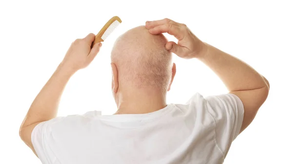Bald senior man — Stock Photo, Image