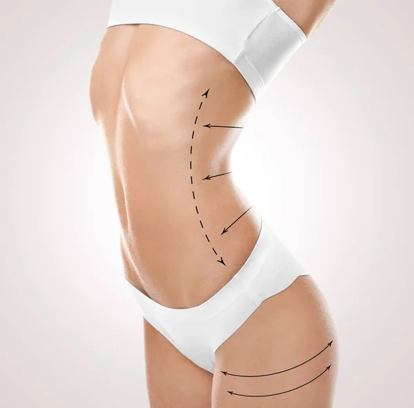 Plastische chirurgie concept — Stockfoto