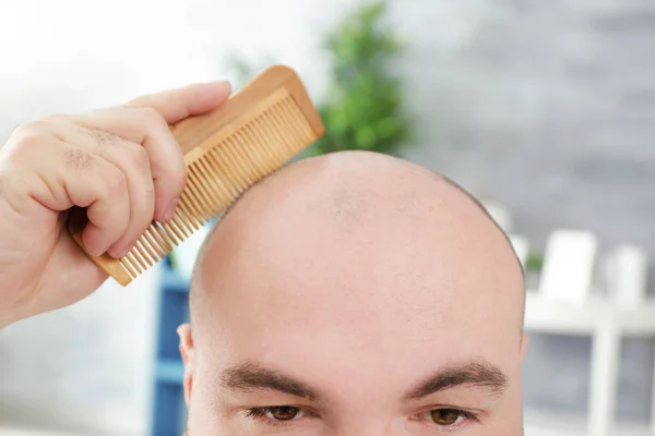 Bald adult man — Stock Photo, Image