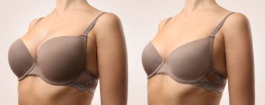 plastik cerrahi kavramı