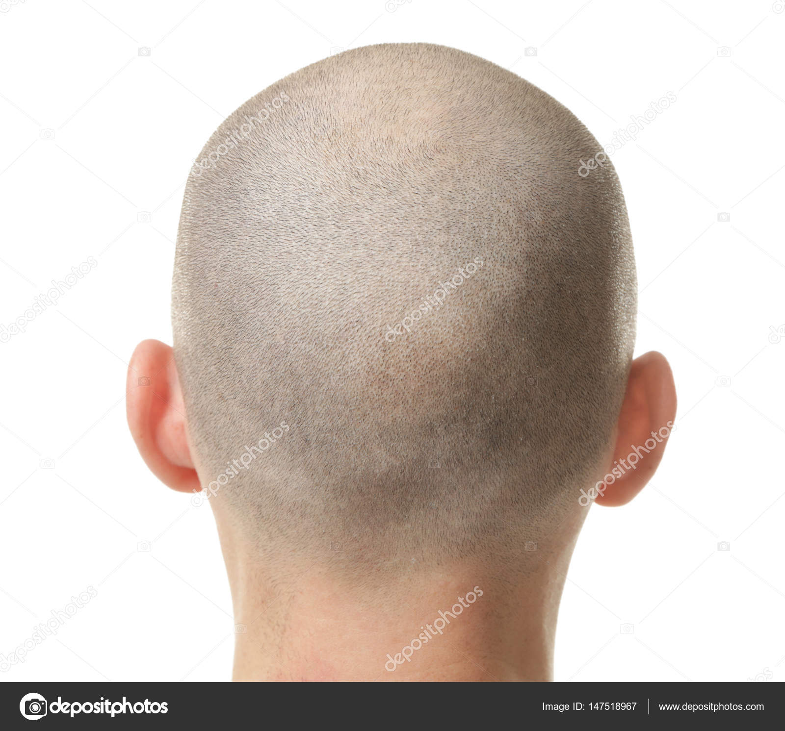 Hair loss concept. Head of man on white background, closeup Stock Photo by  ©belchonock 147518967