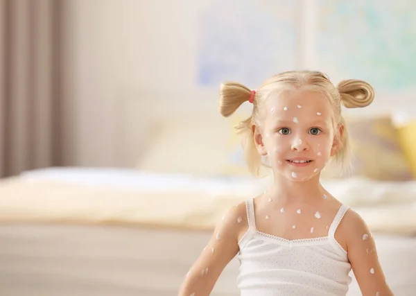 Menina com varicela — Fotografia de Stock