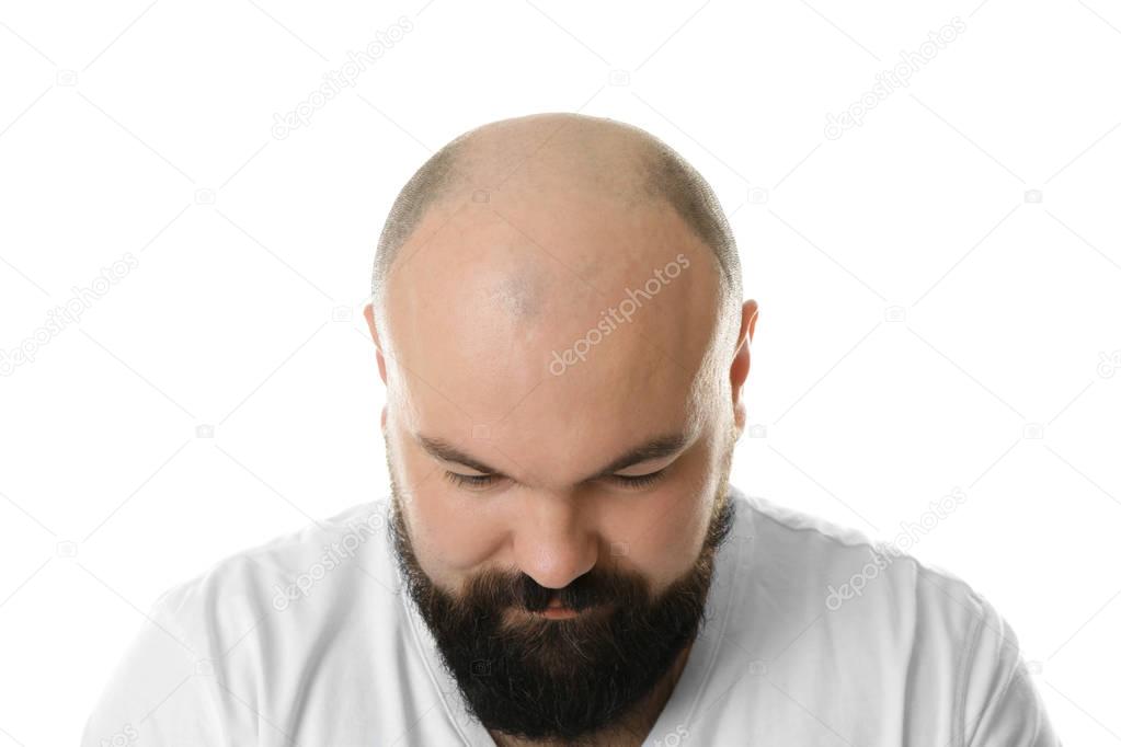 Bald adult man  