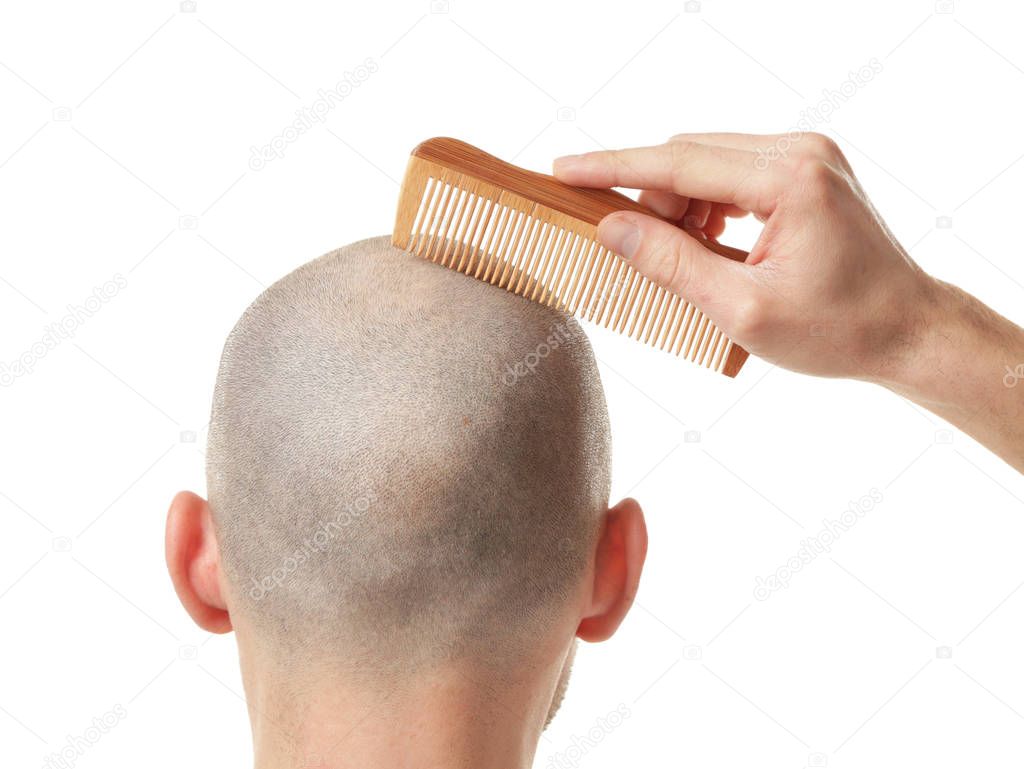 Hair loss concept. Young man with hair comb on white background