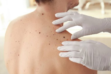 Dermatolog klinikteki hastayı muayene ediyor.