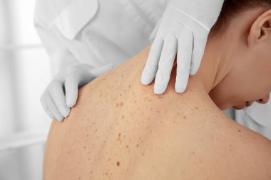 Dermatolog klinikteki hastayı muayene ediyor.