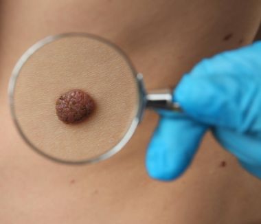 Dermatolog Büyüteç'i muayene hasta ile 