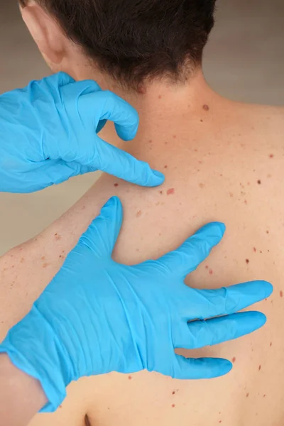 Dermatolog klinikteki hastayı muayene ediyor. — Stok fotoğraf