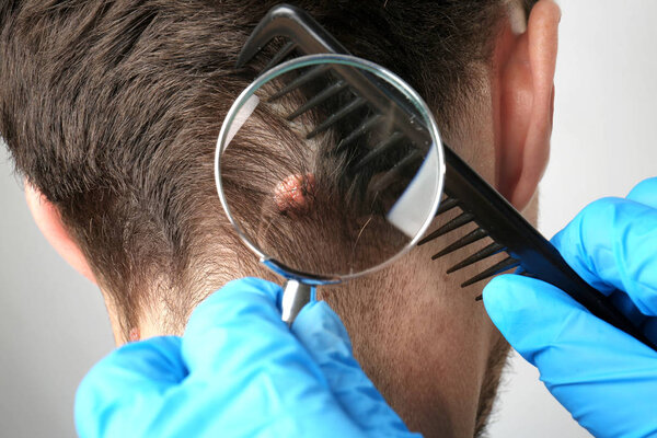 Dermatologist with magnifier examining patient in clinic, closeup
