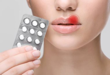 Herpes virüs kavramı