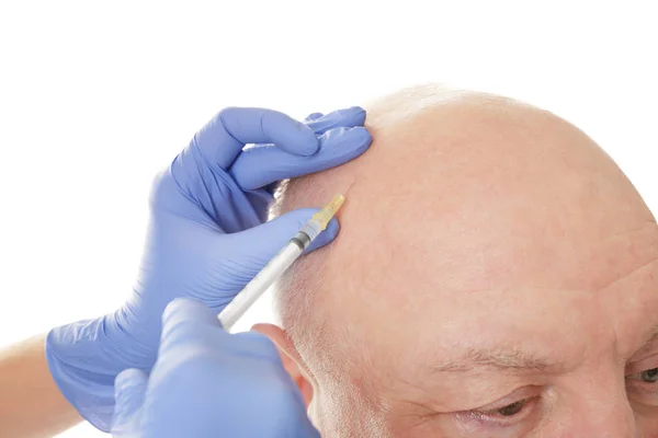 Starszy Człowiek Włosów Utraty Problem Otrzymujący Zastrzyk Białym Tle Zbliżenie — Zdjęcie stockowe